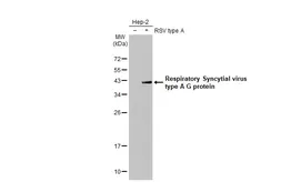 Anti-Respiratory Syncytial virus type A G protein antibody [HL2354] used in Western Blot (WB). GTX638557
