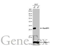 Anti-RanBP1 antibody [HL2358] used in Western Blot (WB). GTX638564