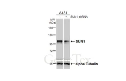 Anti-SUN1 antibody [HL2366] used in Western Blot (WB). GTX638572