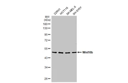 Anti-Wnt10b antibody [HL2370] used in Western Blot (WB). GTX638576