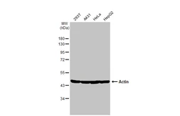 Anti-Actin antibody [HL2372] used in Western Blot (WB). GTX638580