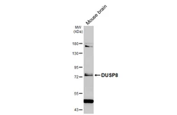 Anti-DUSP8 antibody [HL2374] used in Western Blot (WB). GTX638582
