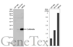 Anti-Calbindin antibody [HL2378] used in Western Blot (WB). GTX638586