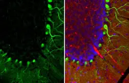 Anti-Calbindin antibody [HL2378] used in IHC (Paraffin sections) (IHC-P). GTX638586