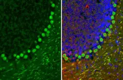 Anti-Calbindin antibody [HL2379] used in IHC (Paraffin sections) (IHC-P). GTX638587
