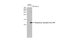 Anti-Respiratory Syncytial virus NS1 antibody [HL2383] used in Western Blot (WB). GTX638591