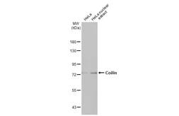Anti-Coilin antibody [HL2384] used in Western Blot (WB). GTX638593