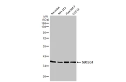 Anti-SUCLG1 antibody [HL2387] used in Western Blot (WB). GTX638596