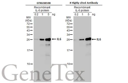 Anti-IL6 antibody [HL2389] used in Western Blot (WB). GTX638598