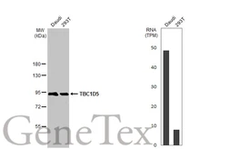 Anti-TBC1D5 antibody [HL2390] used in Western Blot (WB). GTX638599