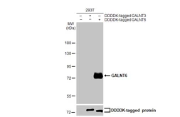 Anti-GALNT6 antibody [HL2392] used in Western Blot (WB). GTX638601