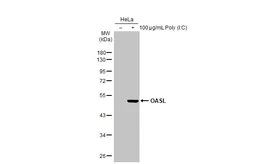 Anti-OASL antibody [HL2399] used in Western Blot (WB). GTX638616