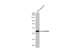 Anti-BCKDHA antibody [HL2405] used in Western Blot (WB). GTX638622