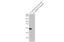 Anti-Yellow Fever virus Envelope Protein antibody [HL2409] used in Western Blot (WB). GTX638626