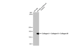 Anti-Collagen I + Collagen II + Collagen III antibody [HL2048 + HL1907] used in Western Blot (WB). GTX638633