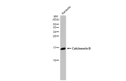 Anti-Calcineurin B antibody [HL2419] used in Western Blot (WB). GTX638641