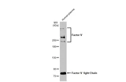Anti-Factor V antibody [HL2421] used in Western Blot (WB). GTX638643