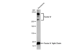 Anti-Factor V antibody [HL2421] used in Western Blot (WB). GTX638643