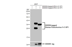 Anti-Human Parechovirus 1+3 VP1 antibody [HL2427] used in Western Blot (WB). GTX638649
