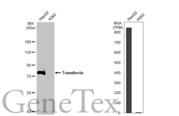 Anti-Transferrin antibody [HL2429] used in Western Blot (WB). GTX638745