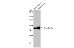 Anti-Transferrin antibody [HL2429] used in Western Blot (WB). GTX638745