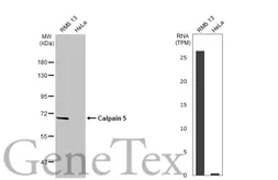 Anti-Calpain 5 antibody [HL2432] used in Western Blot (WB). GTX638748