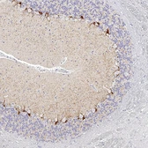 Anti-Adenosine A1 Receptor antibody [HL2442] used in IHC (Paraffin sections) (IHC-P). GTX638758
