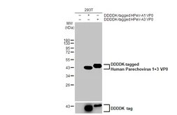 Anti-Human Parechovirus 1+3 VP0 antibody [HL2443] used in Western Blot (WB). GTX638759