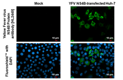 Anti-Yellow Fever virus NS4B Protein antibody [HL2449] used in Immunocytochemistry/ Immunofluorescence (ICC/IF). GTX638767