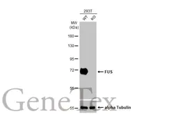 Anti-FUS antibody [HL2454] used in Western Blot (WB). GTX638772