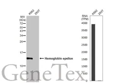 Anti-Hemoglobin epsilon antibody [HL2457] used in Western Blot (WB). GTX638775