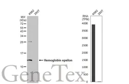 Anti-Hemoglobin epsilon antibody [HL2458] used in Western Blot (WB). GTX638776