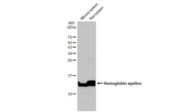 Anti-Hemoglobin epsilon antibody [HL2458] used in Western Blot (WB). GTX638776
