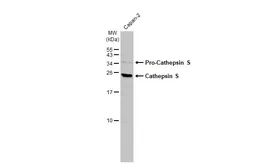 Anti-Cathepsin S antibody [HL2462] used in Western Blot (WB). GTX638780