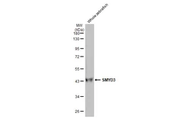 Anti-SMYD3 antibody [HL2464] used in Western Blot (WB). GTX638782