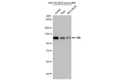 Anti-Rb antibody [HL2465] used in Western Blot (WB). GTX638814