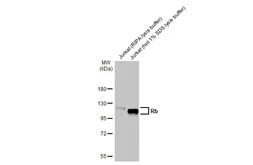 Anti-Rb antibody [HL2465] used in Western Blot (WB). GTX638814