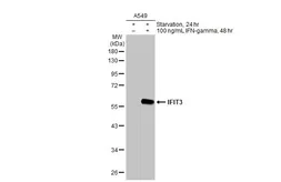 Anti-IFIT3 antibody [HL2468] used in Western Blot (WB). GTX638817