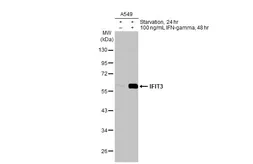Anti-IFIT3 antibody [HL2469] used in Western Blot (WB). GTX638818