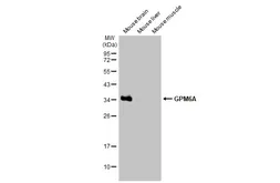 Anti-GPM6A antibody [HL2473] used in Western Blot (WB). GTX638822
