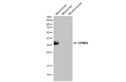 Anti-GPM6A antibody [HL2474] used in Western Blot (WB). GTX638823