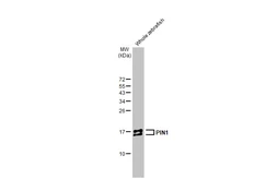 Anti-PIN1 antibody [HL2480] used in Western Blot (WB). GTX638829