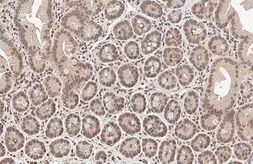 Anti-PIN1 antibody [HL2480] used in IHC (Paraffin sections) (IHC-P). GTX638829