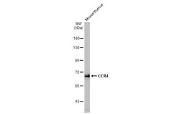 Anti-CCR4 antibody [HL2481] used in Western Blot (WB). GTX638830