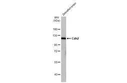 Anti-Cdh2 antibody [HL2496] used in Western Blot (WB). GTX638854