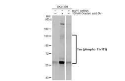 Anti-Tau (phospho Thr181) antibody [HL2497] used in Western Blot (WB). GTX638855