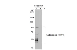 Anti-Tau (phospho Thr181) antibody [HL2498] used in Western Blot (WB). GTX638856