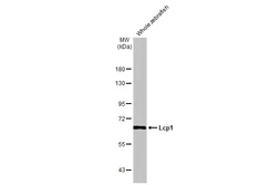 Anti-Lcp1 antibody [HL2501] used in Western Blot (WB). GTX638859