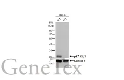 Anti-p27 Kip1 antibody [HL2508] used in Western Blot (WB). GTX638869