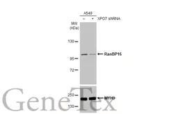 Anti-RanBP16 antibody [HL2510] used in Western Blot (WB). GTX638871